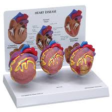 Mini Set de corazón tamaño reducido