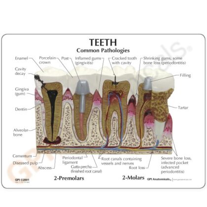 Modelo de dientes - Imagen 3