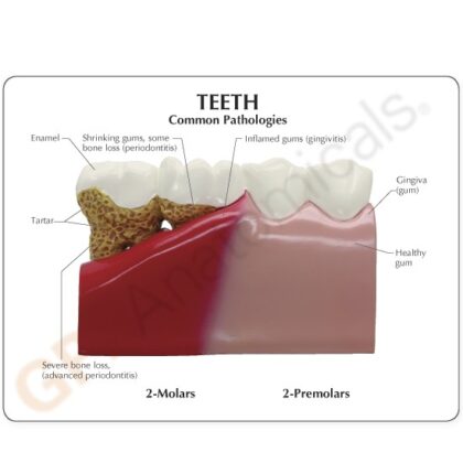 Modelo de dientes - Imagen 4