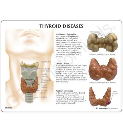 Modelo de tiroides - Imagen 2