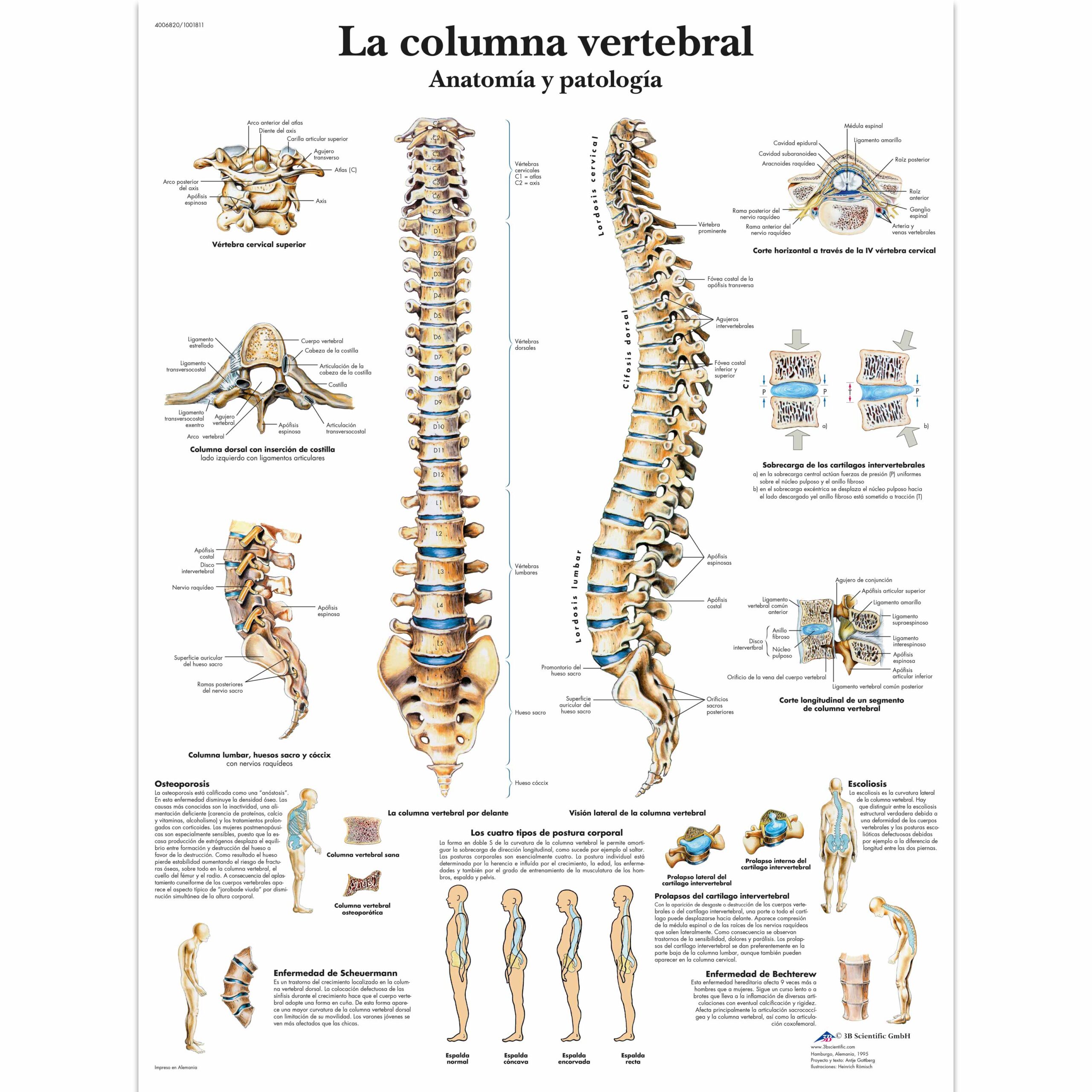 VR3152L_01_3200_3200_La-columna-vertebral-Anatomia-y-patologia