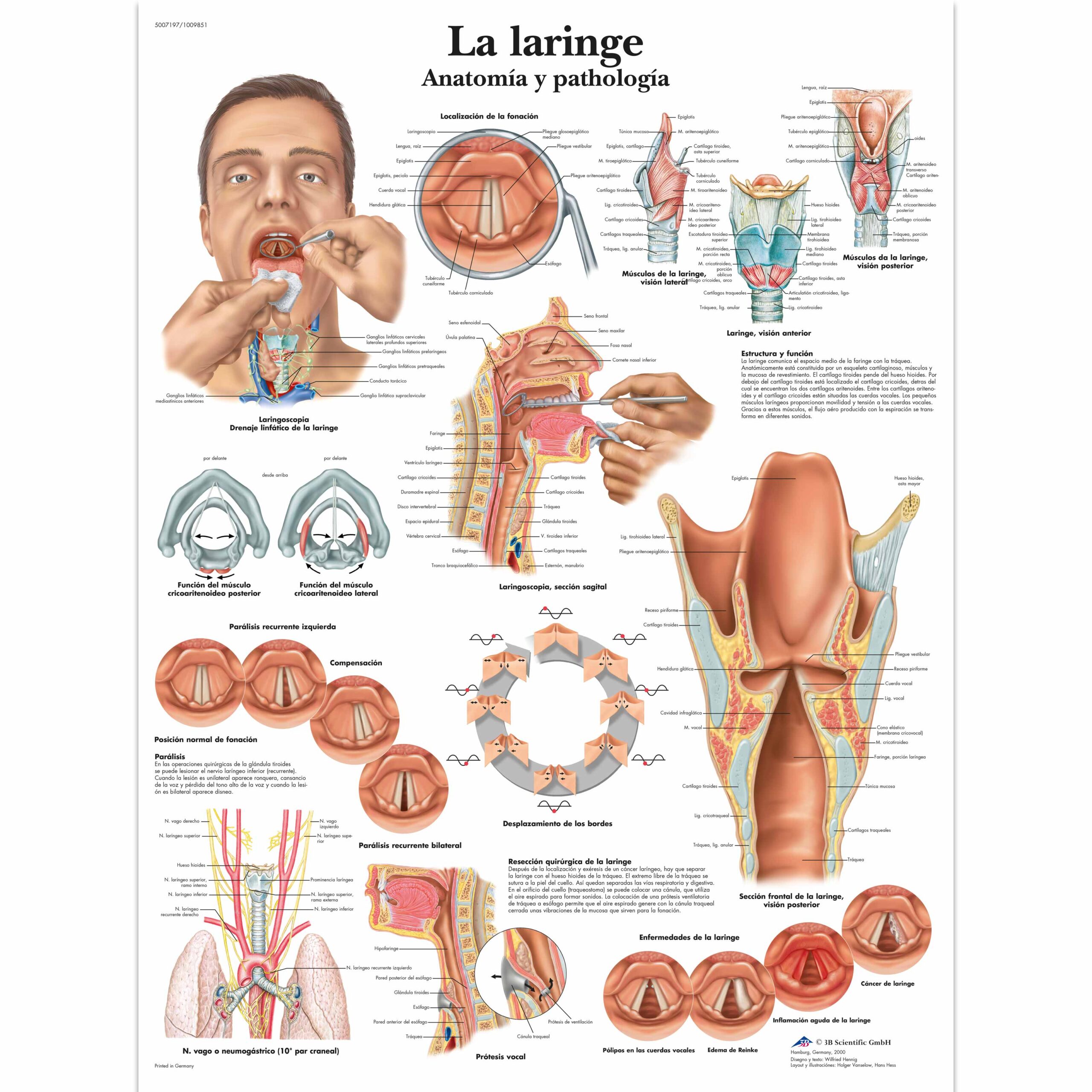 VR3248L_01_3200_3200_La-laringe