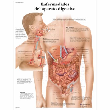 Enfermedades del apparato digestivo Lámina