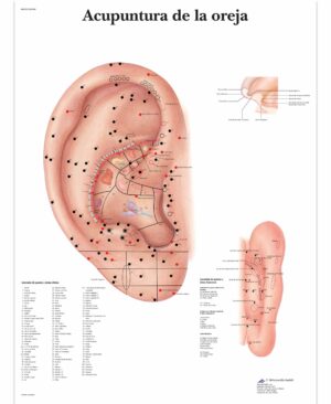 Acupuntura de la oreja