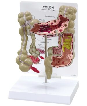 Colon
