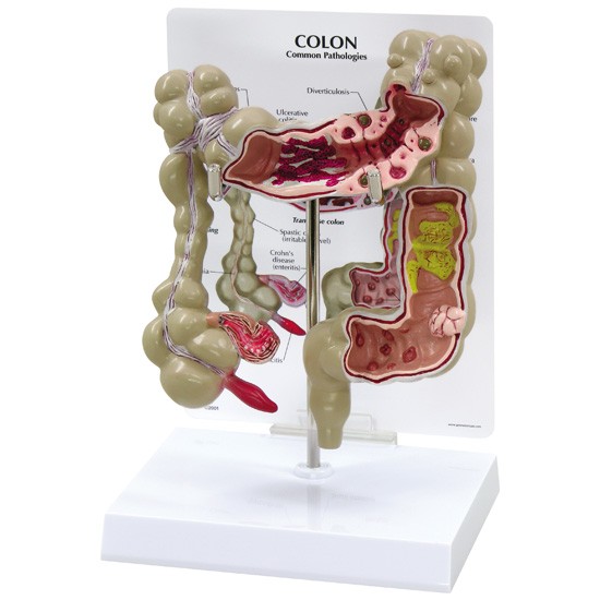 colon-model-1