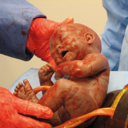 Simulador obstétrico de extracciones fetales en partos por cesárea C-Celia - Imagen 2