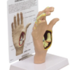 Mano con Osteoartritis