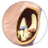 Mano con Osteoartritis - Imagen 2