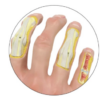 Mano con Osteoartritis - Imagen 3