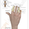 Mano con Osteoartritis - Imagen 4