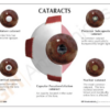 Ojo con Cataratas - Imagen 3