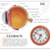Ojo con Cataratas - Imagen 4