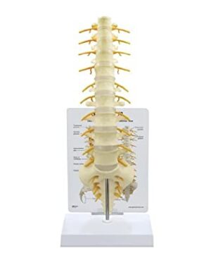 Columna T8 a Sacro