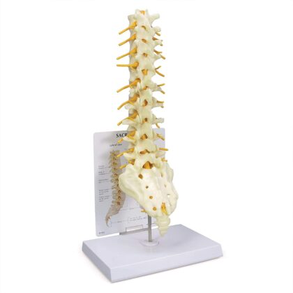 Columna T8 a Sacro - Imagen 3
