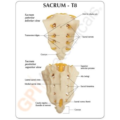 Columna T8 a Sacro - Imagen 4