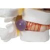 Simulador Vertebral - Imagen 2