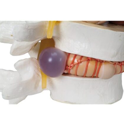 Simulador Vertebral - Imagen 2