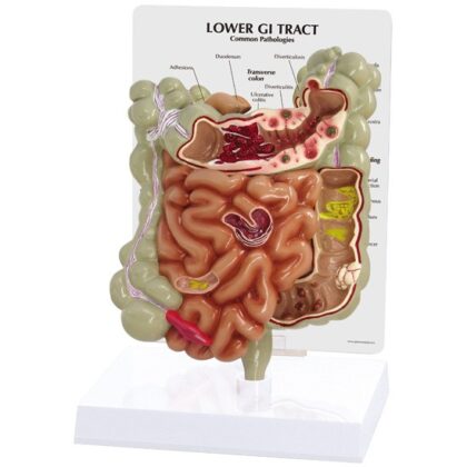 Tracto Intestinal Bajo