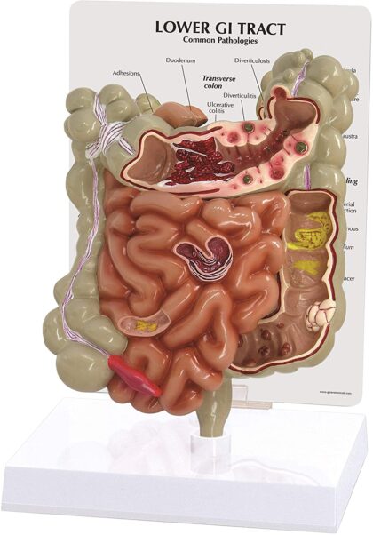 Modelo de Tracto Gastro Intestinal