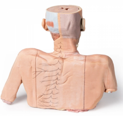 Cabeza, Cuello y con Angiosomas - Imagen 7