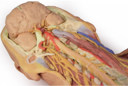 Pared Posterior del Cuerpo ( Disección Profunda Ventral) - Imagen 4