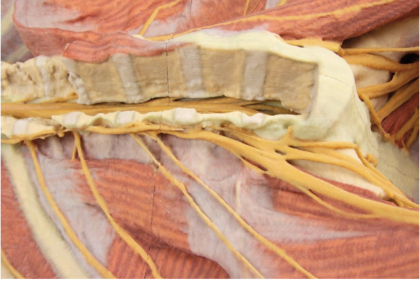Pared Posterior del Cuerpo ( Disección Profunda Ventral) - Imagen 3