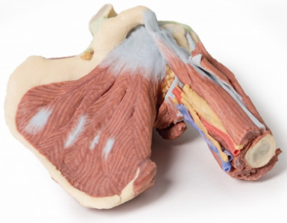 Hombro- Disección Profunda de la Articulación del Hombro Izquierdo, La Musculatura, Nervios y Vasos Asociados - Imagen 3