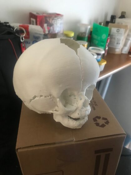 Impresión 3D Modelos Anatómicos - Imagen 18