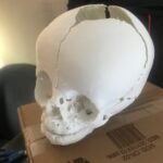 Impresión 3D Modelos Anatómicos