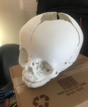 Impresión 3D Modelos Anatómicos