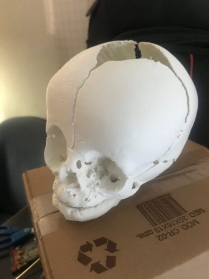 Impresión 3D Modelos Anatómicos