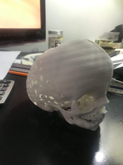 Impresión 3D Modelos Anatómicos - Imagen 6