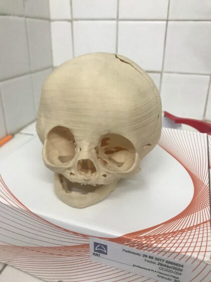 Impresión 3D Modelos Anatómicos - Imagen 2