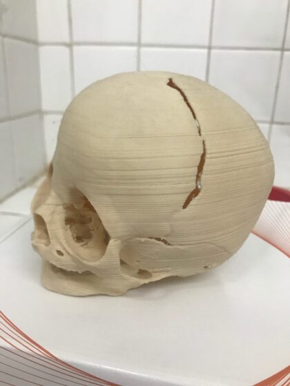 Impresión 3D Modelos Anatómicos - Imagen 3
