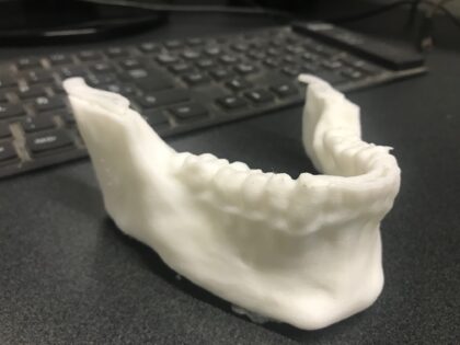 Impresión 3D Modelos Anatómicos - Imagen 10