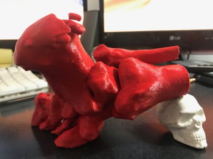 Impresión 3D Modelos Anatómicos - Imagen 12