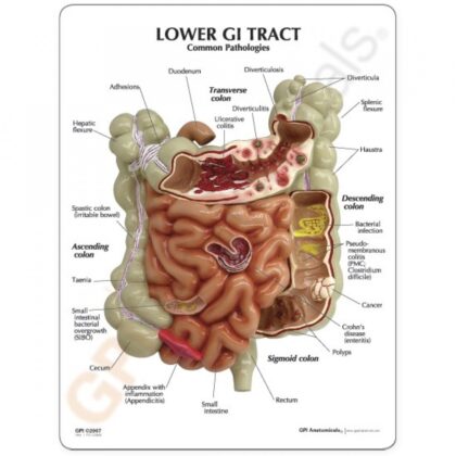 Modelo de Tracto Gastro Intestinal - Imagen 3