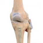 Articulación de la Rodilla Extendida