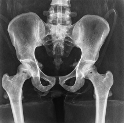 Phantom Rayos X Cuerpo Completo - Imagen 7