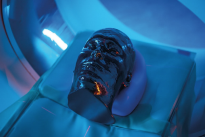 Phantom de cabeza y cuello para TC, rayos X y radioterapia - Imagen 2