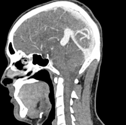 Phantom de cabeza y cuello para TC, rayos X y radioterapia - Imagen 7
