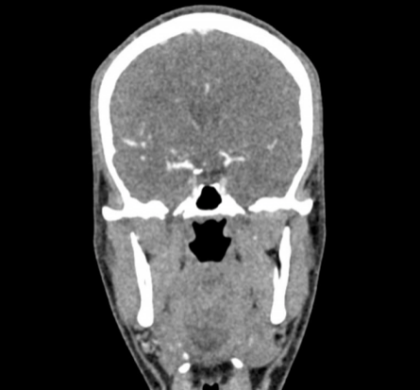 Phantom de cabeza y cuello para TC, rayos X y radioterapia - Imagen 5