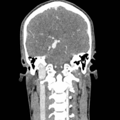 Phantom de cabeza y cuello para TC, rayos X y radioterapia - Imagen 10